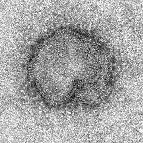 Virus de la influenza A H7N9 de forma esférica como se observa a través de un microscopio de electrones (Fuente: CDC).